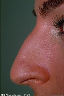 鼻炎的症状及治疗中医治鼻炎专家吕大夫提供免费咨询服务