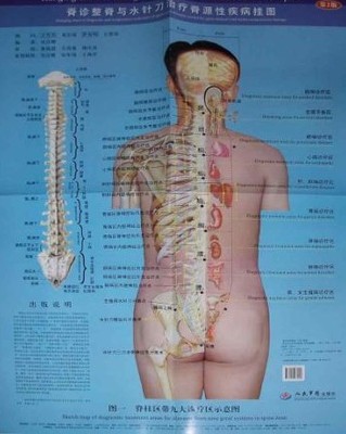 水针刀微创疗法介绍及优势