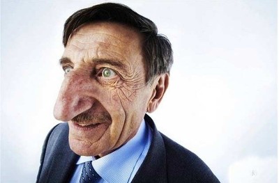 中药排毒疗法治疗各种鼻炎 中医治疗鼻炎疗效好